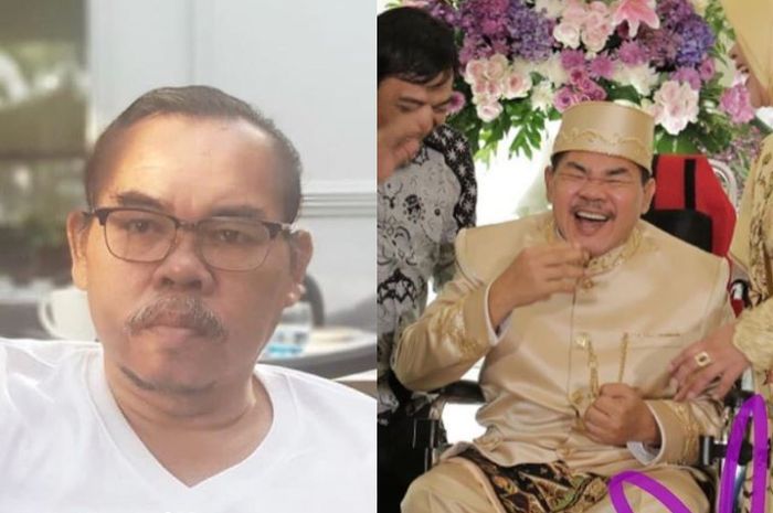 5 Tanda-Tanda Stroke: Penyebab Kematian Mat Solar Setelah Berjuang Sejak 2017