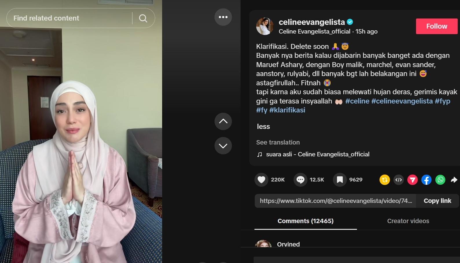 Celine Evangelista Buka Rahasia Hubungannya dengan Pejabat Tinggi: Bukan Soal Istri Kelimanya