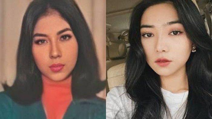 Kenali Risiko Pecahnya Pembuluh Darah seperti Kasus Titiek Puspa