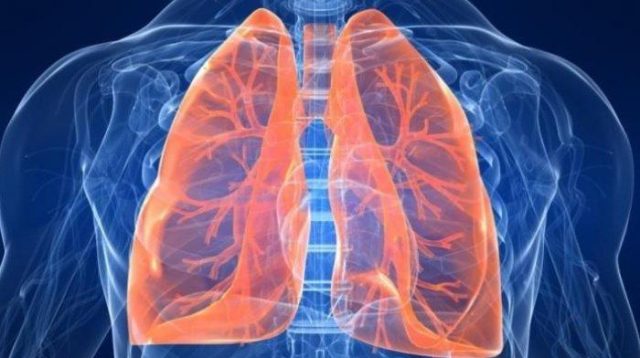 Dokter Thifla, Ahli Paru, Jelaskan Gejala PPOK Dokter Thifla, Ahli Paru, Jelaskan Gejala PPOK