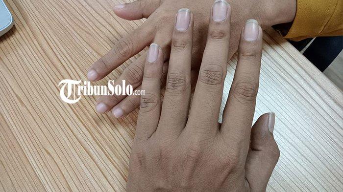 Seniman Sukoharjo Dikaitkan dengan Kekerasan Seks, Pengacara Korban Bantah Buka Identitas