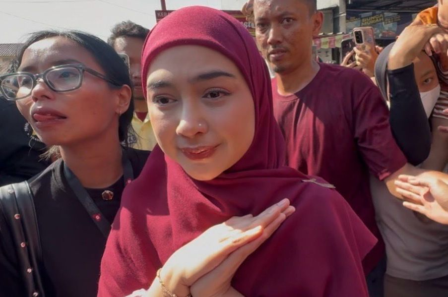 Ria Ricis akhirnya buka suara soal oplas hidung, alami kondisi ini selama 5 tahun hingga butuh tulang iga